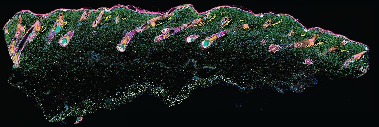 Spatial transcriptomics